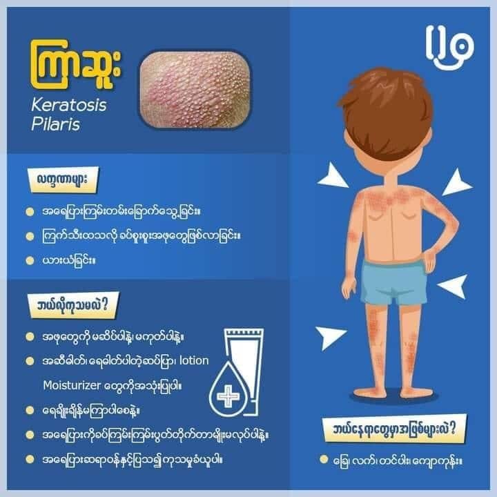 keratosis 2